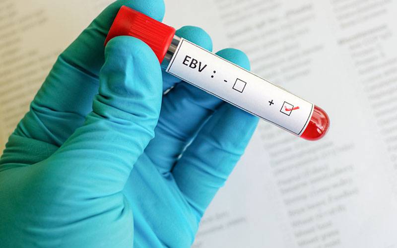 Vírus Epstein-Barr pode ser causa de esclerose múltipla