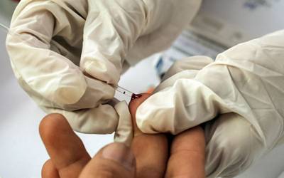 Descoberta variante mais viral e contagiosa do VIH