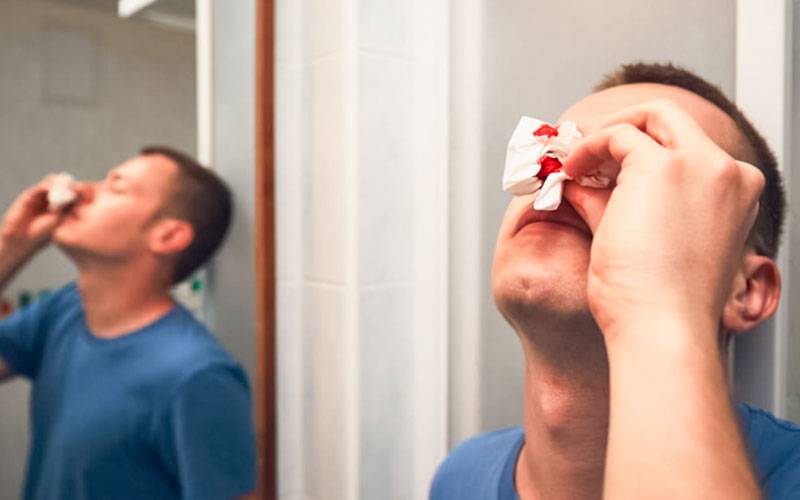 Hemorragia nasal: conheça as causas e o que fazer