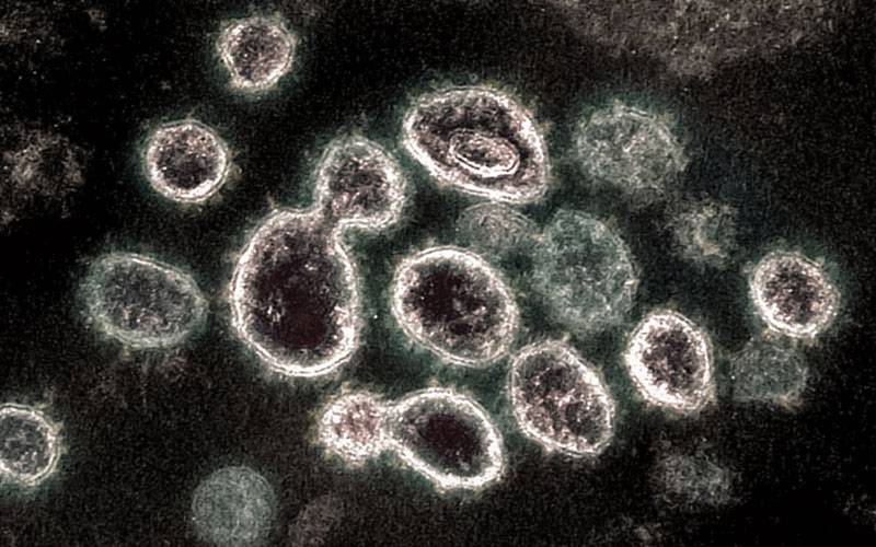 Coronavírus: porque razão algumas pessoas não apanham Covid?