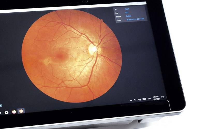 Aparelho de exame ocular inovador é desenvolvido no Brasil