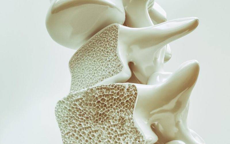 Níveis de hormona detetam perda óssea em mulheres