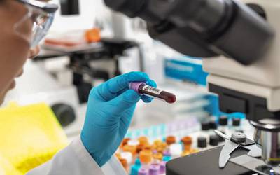 Hemofilia: nova terapia genética pode reduzir risco de hemorragia