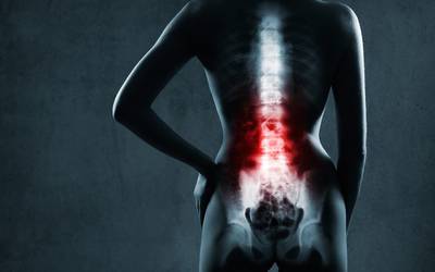 Maioria das lesões da coluna vertebral são preveníveis
