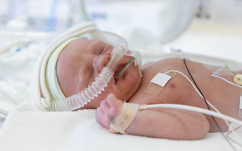 Mais perto de um tratamento para doença pulmonar fatal em bebés