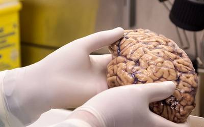 Cérebro adulto pode não ser tão rígido quanto se pensava