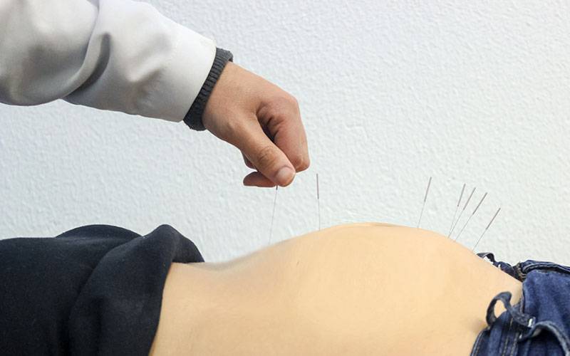 Acupunctura pode aliviar dor lombar e pélvica durante a gravidez