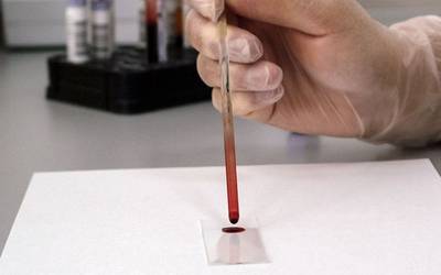Grupo sanguíneo pode prever risco de contrair doenças virais