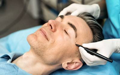 Cirurgia estética masculina: conheça os procedimentos mais comuns