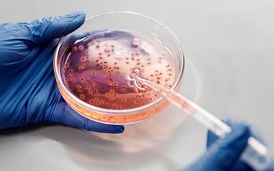 Cientistas descobrem segredo da virulência da bactéria Strep A