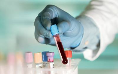Novo teste de sangue deteta risco de Alzheimer com precisão