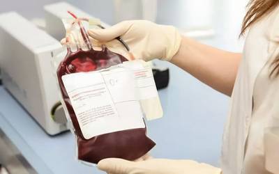Sexo do doador de sangue não influencia sobrevivência do receptor