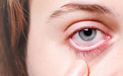 Probiótico oral promissor no tratamento da doença do olho seco