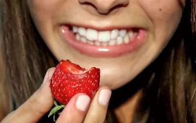 Branqueamento dentário: conheça os alimentos que ajudam