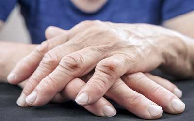 Aprender a Viver com Artrite Reumatoide