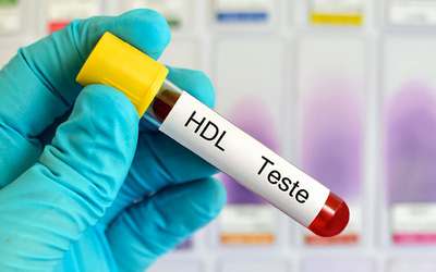 Colesterol HDL alto e baixo associado a maior risco de demência