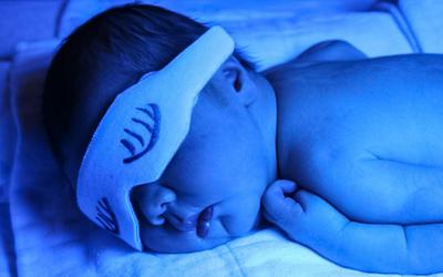 Icterícia neonatal: conheça as causas e o tratamento