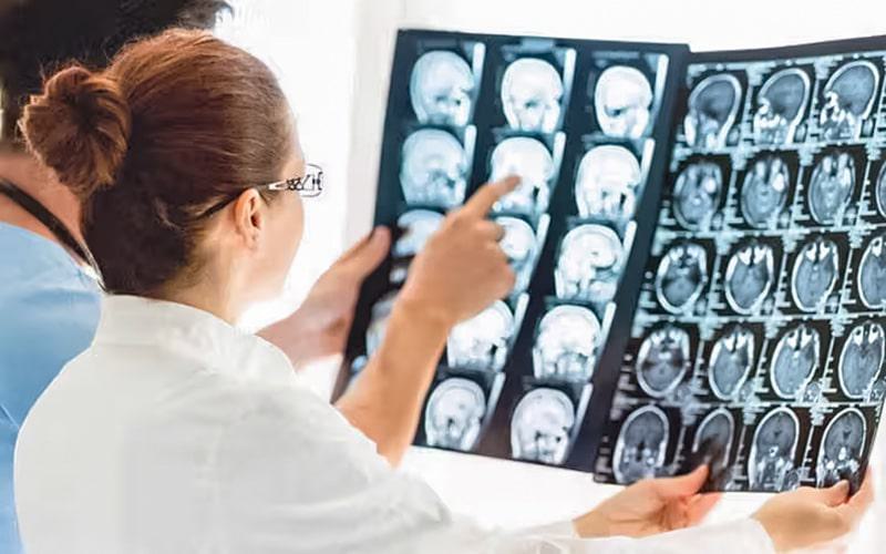 Medicamento experimental pode retardar tumores cerebrais infantis