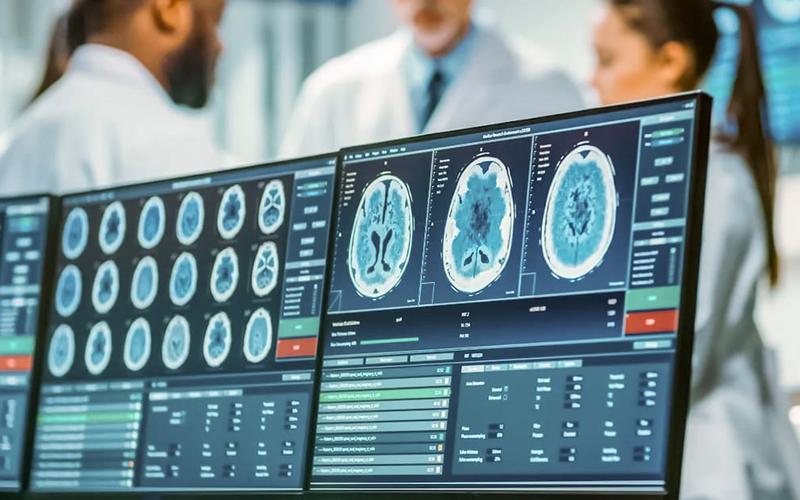 Estudo revela como um gene para a obesidade afeta o cérebro Estudo revela como um gene para a obesidade afeta o cérebro