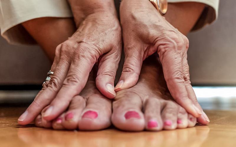 Genética é uma das principais causas de gota Genética é uma das principais causas de gota
