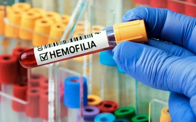 Descoberta pode melhorar o tratamento de pessoas com hemofilia A