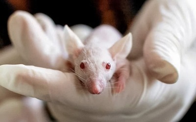Obesidade contribui para ansiedade e comprometimento cognitivo