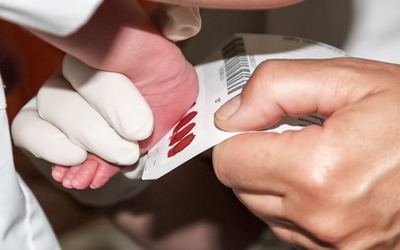Teste de Guthrie permite diagnosticar precocemente várias doenças