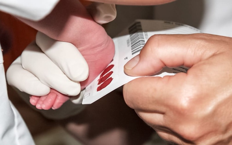 Teste de Guthrie permite diagnosticar precocemente várias doenças Teste de Guthrie permite diagnosticar precocemente várias doenças