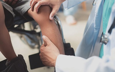 Apitegromab melhora a função motora na atrofia muscular espinal