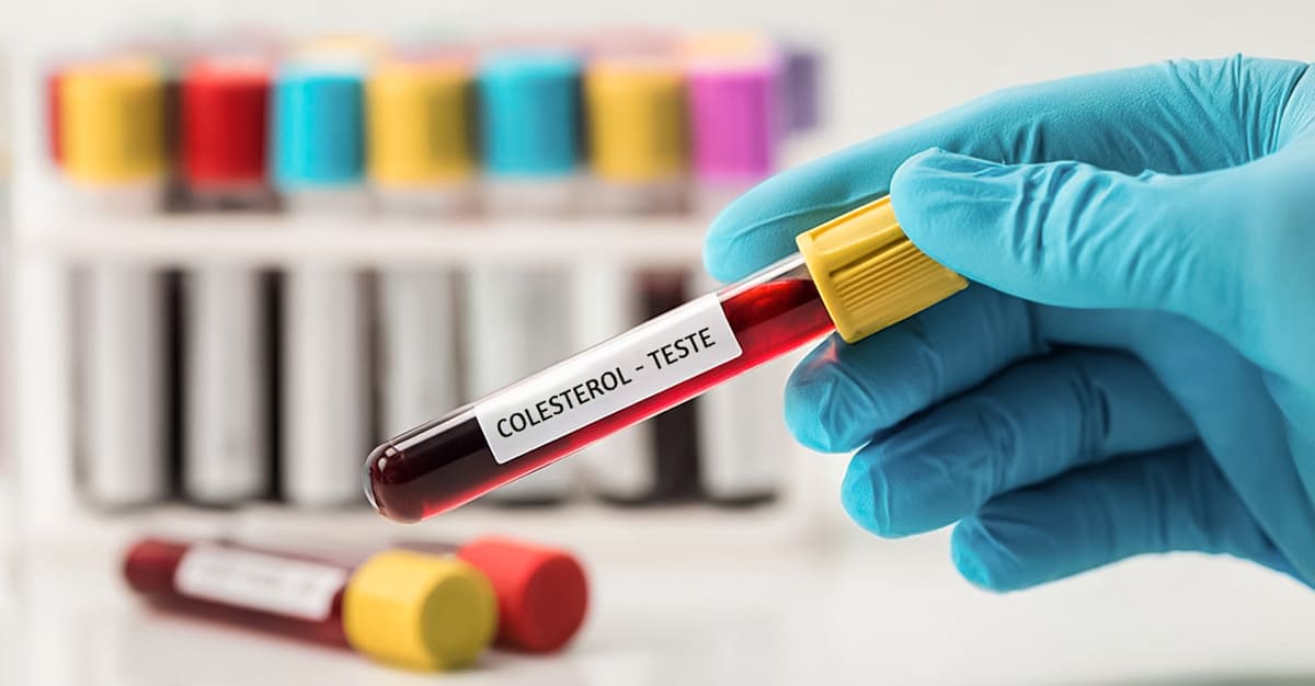 Notícias - Níveis baixos de colesterol LDL associados a maior risco de DT2