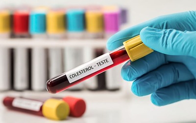 Níveis baixos de colesterol LDL associados a maior risco de DT2