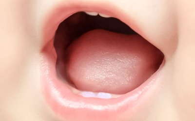 Stress materno acelera momento da erupção dentária do bebé