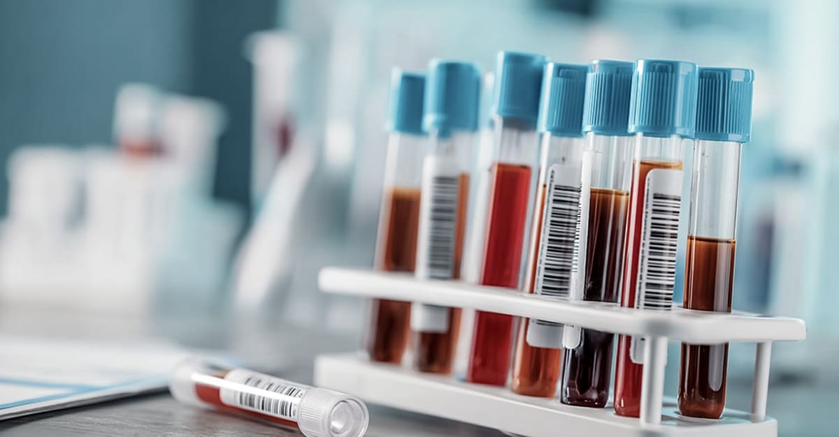 Notícias - Análise sanguínea revela risco de multimorbilidade em idosos