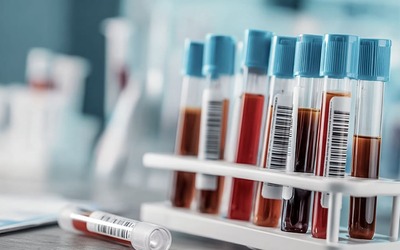 Análise sanguínea revela risco de multimorbilidade em idosos