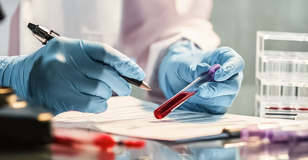 Notícias - Carência de vitamina K perturba processo de coagulação sanguínea