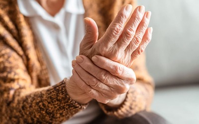 Notícias - Tratamento precoce pode atrasar artrite reumatoide durante anos