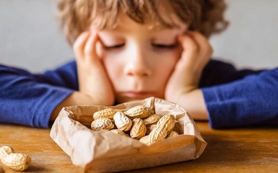 Alergias infantis: identificados fatores que mais elevam o risco