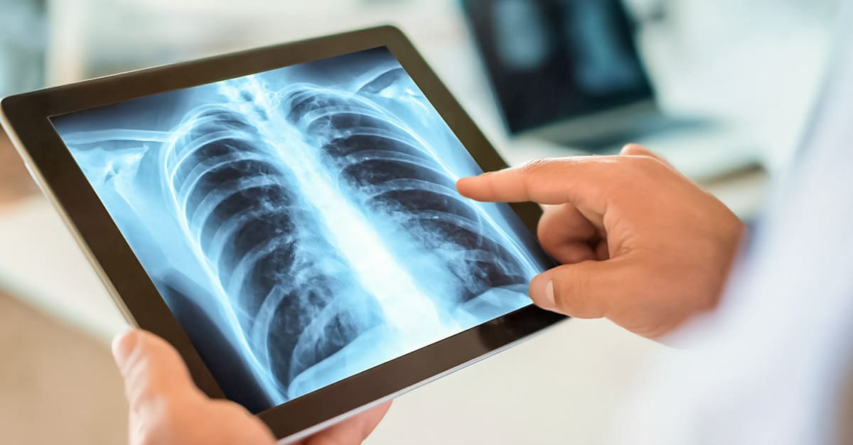 Notícias - Falta de uma proteína pode explicar algumas doenças respiratórias