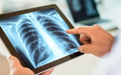 Falta de uma proteína pode explicar algumas doenças respiratórias