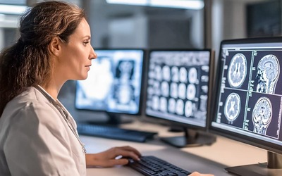 Privação do sono pode danificar as ligações do cérebro