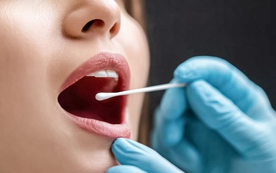 Células da bochecha podem dar pistas sobre risco de esquizofrenia