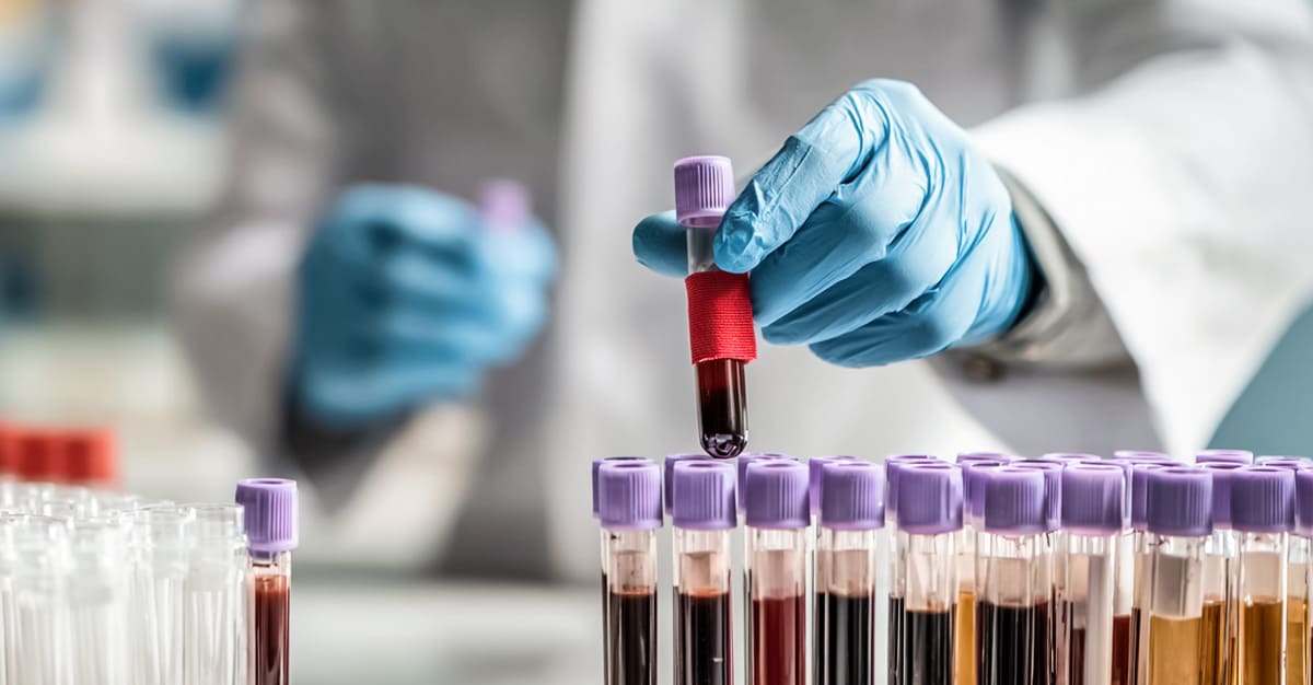 Notícias - Novo exame ao sangue indica quem poderá viver mais tempo