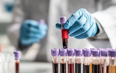 Novo exame ao sangue indica quem poderá viver mais tempo