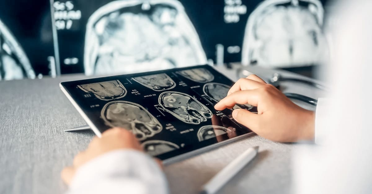 Notícias - Novo anticoagulante reduz acidentes cerebrovasculares em 26%