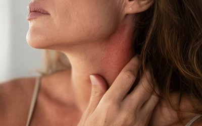 Stress psicológico pode agravar dermatite atópica