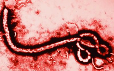 Surto de Ébola alarga‑se em grande parte sem ser detetado